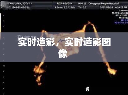 实时造影,实时造影图像