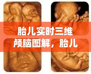 胎儿实时三维颅脑图解,胎儿三维视频