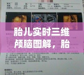 胎儿实时三维颅脑图解,胎儿三维视频