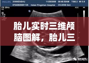 胎儿实时三维颅脑图解,胎儿三维视频