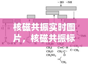 核磁共振实时图片,核磁共振标准图谱