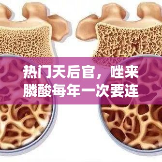 热门天后官,唑来膦酸每年一次要连续注射吗