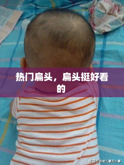 热门扁头,扁头挺好看的