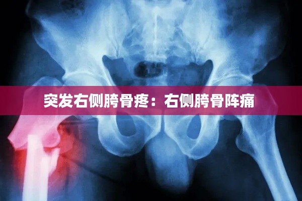 突发右侧胯骨疼:右侧胯骨阵痛