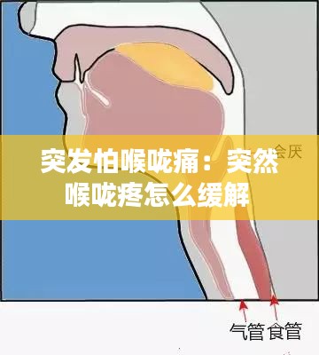 突发怕喉咙痛:突然喉咙疼怎么缓解