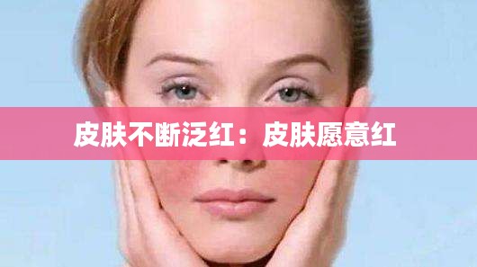 皮肤不断泛红:皮肤愿意红
