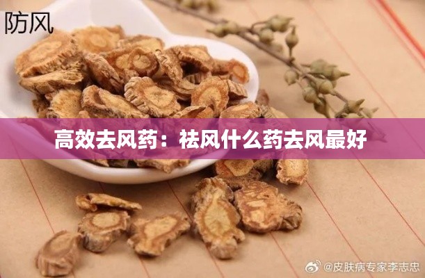 高效去风药:祛风什么药去风最好