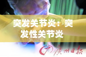 突发关节炎:突发性关节炎