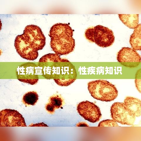性病宣传知识:性疾病知识