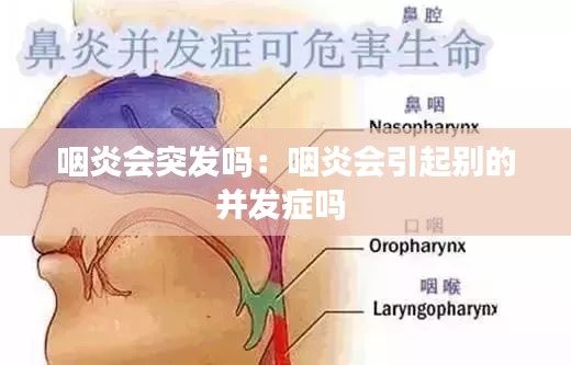咽炎会突发吗:咽炎会引起别的并发症吗