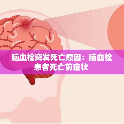 脑血栓突发死亡原因:脑血栓患者死亡前症状