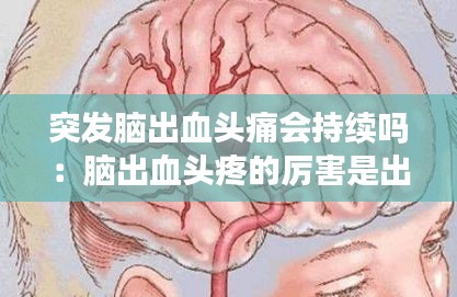 突发脑出血头痛会持续吗:脑出血头疼的厉害是出血加重了吗?
