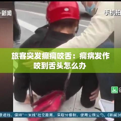 旅客突发癫痫咬舌:痫病发作咬到舌头怎么办