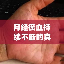 月经瘀血持续不断的真相,成因、影响及应对之策