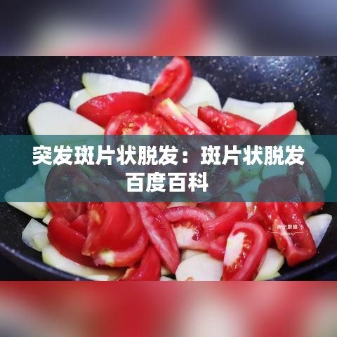 突发斑片状脱发:斑片状脱发百度百科