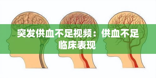突发供血不足视频:供血不足临床表现