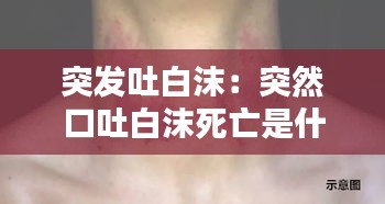 突发吐白沫:突然口吐白沫死亡是什么原因?
