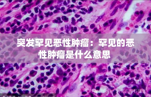 突发罕见恶性肿瘤:罕见的恶性肿瘤是什么意思