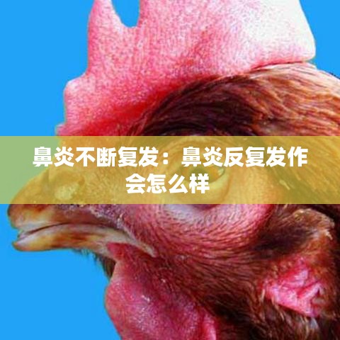 鼻炎不断复发:鼻炎反复发作会怎么样