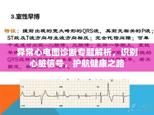 异常心电图诊断专题解析,识别心脏信号,护航健康之路