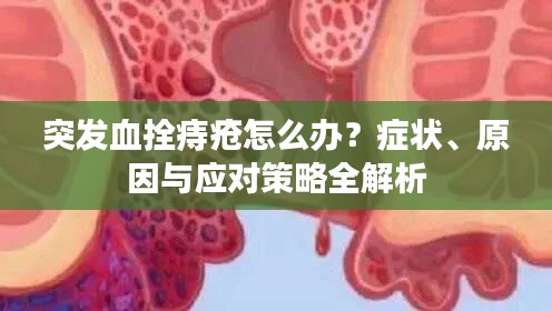突发血拴痔疮怎么办?症状、原因与应对策略全解析