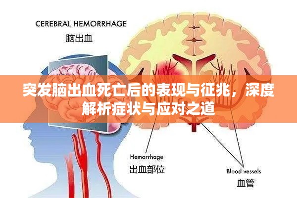 突发脑出血死亡后的表现与征兆,深度解析症状与应对之道