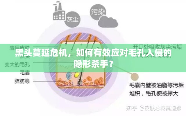 黑头蔓延危机,如何有效应对毛孔入侵的隐形杀手?