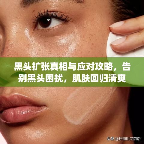 黑头扩张真相与应对攻略,告别黑头困扰,肌肤回归清爽