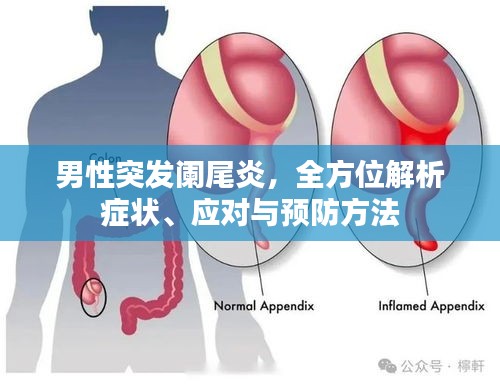 男性突发阑尾炎,全方位解析症状、应对与预防方法