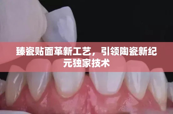 臻瓷贴面革新工艺,引领陶瓷新纪元独家技术