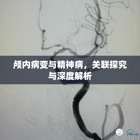 颅内病变与精神病,关联探究与深度解析