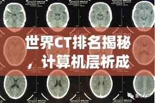 世界CT排名揭秘,计算机层析成像技术的尖端力量